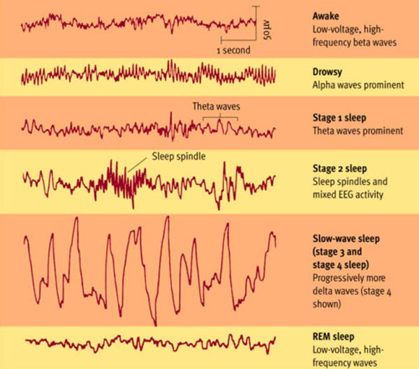 sleep brainwaves